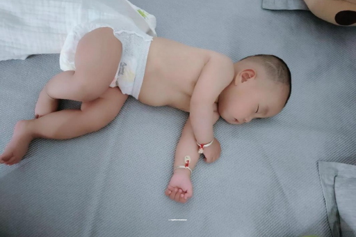 信阳宝宝头上长痱子